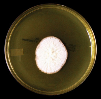 Image: Sarocladium kiliense after 10 days’ growth on Sabouraud-Dextrose Agar at 30 °C (Photo courtesy of Thunderhouse4-yuri).