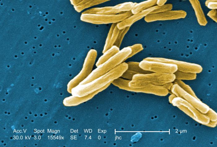 Image: A high magnification (15,549x) scanning electron micrograph (SEM) showing a number of Gram-positive Mycobacterium tuberculosis bacteria (Photo courtesy of the CDC).