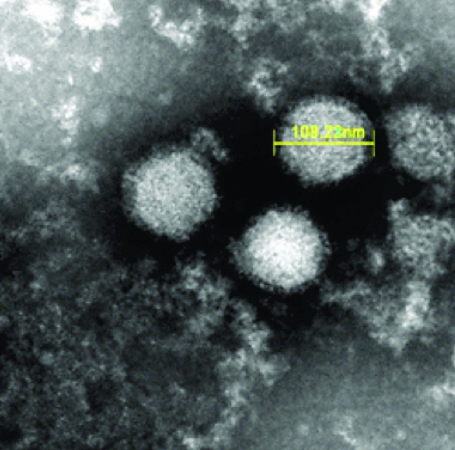 Image: A scanning electron micrograph (SEM) of severe fever with thrombocytopenia syndrome virus (Photo courtesy of the Japanese National Institute of Infectious Diseases).