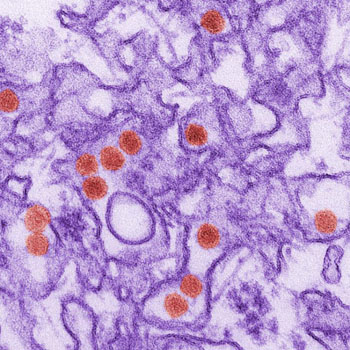 Image: A transmission electron micrograph (TEM) image of the Zikavirus (red disks) (Photo courtesy of the CDC).