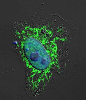 Image: A confocal fluorescence microscopy image of NLRX1 (green) in a HeLa cell (blue, nuclear stain) (Photo courtesy of Dr. Haitao Guo, University of North Carolina).