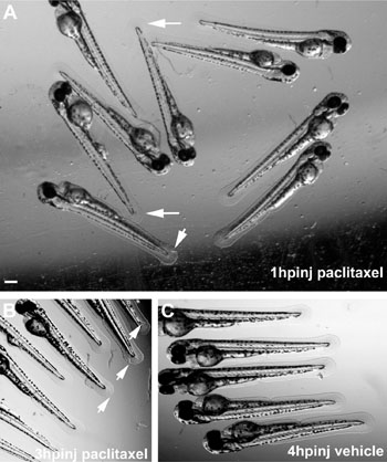 Image: Altered caudal fin morphology following paclitaxel injection into larval zebrafish at 2 dpf. (A) Morphological changes (arrows) in the fin fold 1 hour after injection with 10 µM paclitaxel (insets show higher magnification). (B) Fin damage (arrows) 3 hour after paclitaxel injection. (C) Vehicle controls with undamaged fins 4 hour postinjection. (Scale bar, 200 µm.) hpinj = hours postinjection. (Image courtesy of Lisse TS et al, 2016, PNAS.)