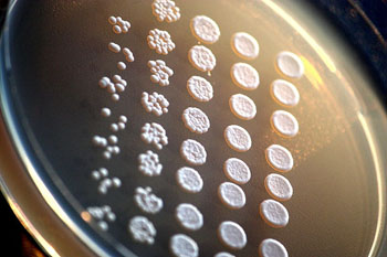 Image: Drop-inoculation of Saccharomyces cerevisiae mutants on an agar plate. The assay compares the viability of different yeast mutants (Photo courtesy of Wikimedia Commons).