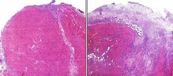 Image: A cross-section of injured mouse muscle tissue, with healthy tissue in pink and scar tissue shown in purple. Both mice genetically lack T-cells; the mouse on the left was injected with T-cells that became type II helper T-cells and aided healing (Photo courtesy of Dr. Kenneth Estrellas, Johns Hopkins University).