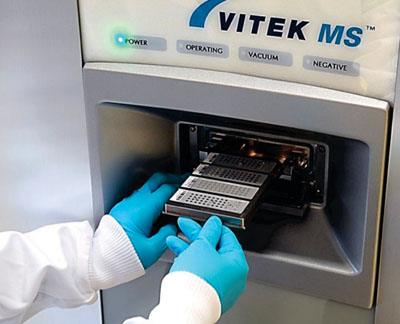 Image: The Vitek MS laser desorption ionization time-of-flight mass spectrometry for identification of bacteria platform (Photo courtesy of bioMérieux).