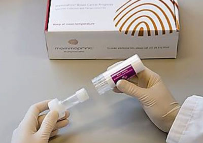 Image: The MammaPrint DNA microarray test for breast cancer prognosis (Photo courtesy of Agendia).