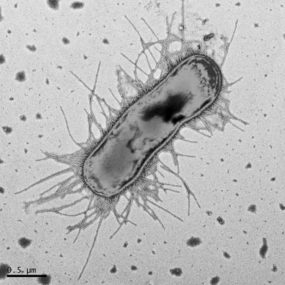 Image A: A scanning electron micrograph (SEM) of an E. coli bacterium of the pandemic H30 strain (Photo courtesy of the University of Washington).