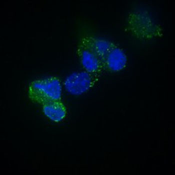 Image: A photomicrograph of human brain tumor stem cells expressing the OSMR gene (green) (Photo courtesy of Dr. Arezu Jahani-Asl, McGill University).