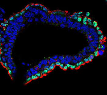 Image: A photomicrograph shows a well-differentiated structure derived from normal embryonic stem cells, with all nuclei stained blue. Only endoderm cells (green) contain high levels of lysosomes (red) (Photo courtesy of Dr. Anwesh Kamireddy, Salk Institute for Biological Sciences).