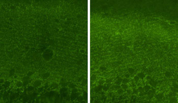 Image: After treatment with riluzole, the brains of old rats showed more of a transporter molecule that removes excess glutamate, (green fluorescence, right) as compared to untreated rats (left) (Photo courtesy of The Rockefeller University).