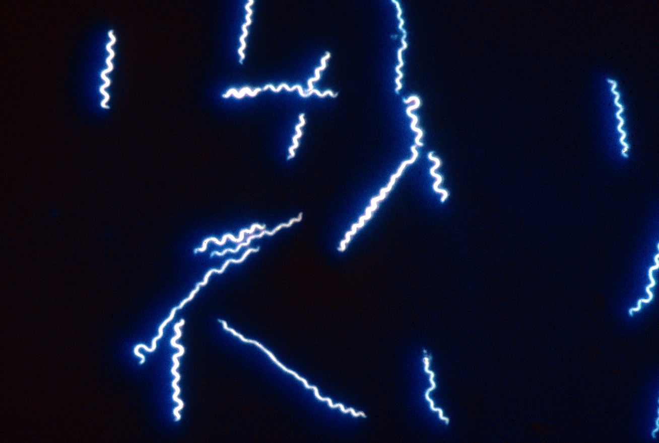 Микрофотография, полученная при темнопольной микроскопии, показывает присутствие спирохеты (бактерии в форме штопора), относящейся к роду боррелий, которая является болезнетворным микроорганизмом, вызывающим болезнь Лайма (фото любезно предоставлено Джеффри Нельсоном (Jeffrey Nelson)).
