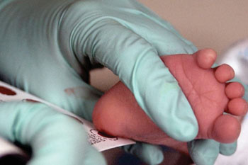 Image: Dried blood spots are used to screen newborns for a number of rare inherited conditions. A new dried blood spot screening test has been developed for Niemann-Pick type C, a rare neurodegenerative condition that usually is not diagnosed until after damage to brain cells has begun (Photo courtesy of Washington University School of Medicine).