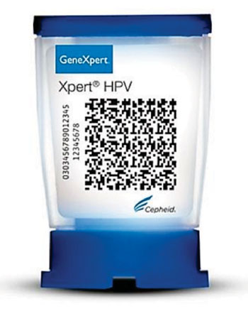Image: The Xpert HPV assay is a qualitative real-time polymerase chain reaction (qRT-PCR) test for automated and rapid detection of Human Papillomaviruses (Photo courtesy of Cepheid).