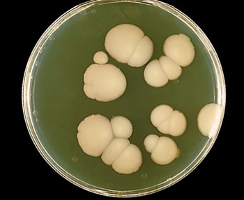 Image: Candida albicans growing on Sabouraud agar (Photo courtesy of Dr. William Kaplan / CDC).
