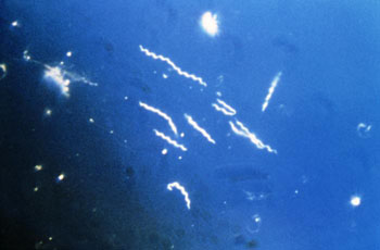 Image: A dark field photomicrograph showing the spirochete bacterium Borrelia burgdorferi, the pathogen responsible for causing Lyme disease (Photo courtesy of the CDC).