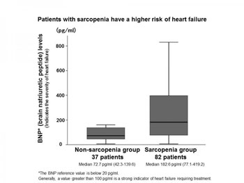 Image: Brain Natriuretic Peptide (BNP) levels in patients with and without sarcopenia. Risk of heart failure is higher in patients with sarcopenia (Photo courtesy of Dr. Yasuhiro Izumiya).