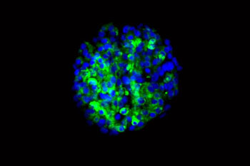 Image: Researchers have produced insulin-secreting cells from stem cells derived from the skin of patients with type I diabetes. The cells (blue), made from stem cells, can secrete insulin (green) in response to glucose (Photo courtesy of Millman Laboratory, Washington University School of Medicine).