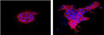 Image: A human breast cell lacking HOXA5 (right) shows protruding structures similar to tumor cells, compared with a normal human breast cell (left) (Photo courtesy of Dr. Sara Sukumar, Johns Hopkins University).