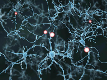 Image: New research suggests that therapies for Parkinson’s disease could be more effective if administered at the early stages of the disease (Photo courtesy of McGill University).