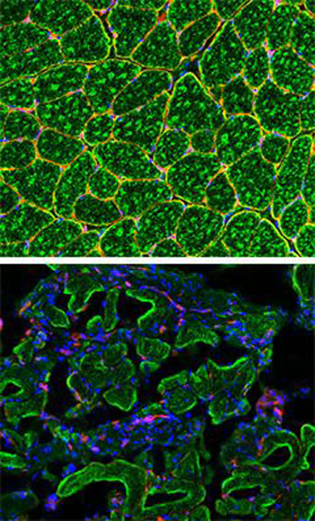 Image: Blocking expression of laminin (red) in pericyte and PIC stem cells in mice caused dramatic alteration to muscle fiber maturation (green), similar to that seen in muscular dystrophy patients (Photo courtesy of Rockefeller University).