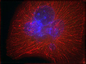 Image: A pancreatic cancer cell. The nucleus is stained blue, while the fibers of the cytoskeleton are labelled with a red fluorescent dye (Photo courtesy of Dr. Nathalie Giese, Chirurgische Universitätsklinik Heidelberg, Germany).
