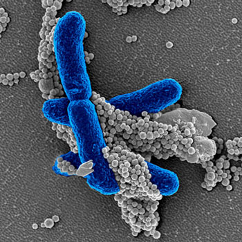 Image: In the new pathogen-detection technology, engineered FcMBL proteins coupled to magnetic beads (grey) specifically bind to carbohydrate molecules on the surface of pathogens, like infectious E. coli (blue) in this electron micrograph, or on fragments of dead pathogens circulating in the bloodstream. After isolation in a magnetic field, the total pathogenic material is quantified with a second FcMBL protein linked to a color-producing enzyme (Photo courtesy of Wyss Institute at Harvard University).