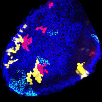 Image: Multipotent stem cells, responsible for the development of the prostate (Photo courtesy of Dr. C. Blanpain, Université libre de Bruxelles).