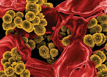 Image: A colorized scanning electron micrograph (SEM) of a strain of Staphylococcus aureus bacteria enmeshed within the pseudopodia of a red-colored human white blood cell (WBC) (Photo courtesy of the National Institute of Allergy and Infectious Diseases).
