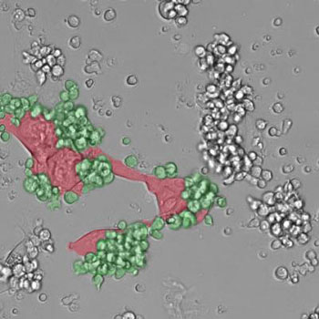 Image: A micrograph showing immune cells (green) attacking tumor cells (red) (Photo courtesy of Dr. Michele De Palma, Ecole Polytechnique Fédérale de Lausanne).