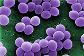 Image: A scanning electron microscope (SEM) image of methicillin-resistant Staphylococcus aureus bacteria (Photo courtesy of the CDC).