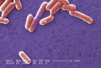 Image: A colorized scanning electron micrograph (SEM) showing a number of Gram-negative Escherichia coli bacteria of the strain O157:H7 (Photo courtesy of the CDC).