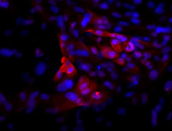 Image: An imunofluorescence image of hPSC-derived pituitary cells after 30 days of differentiation. The cells were stained for adrenocorticotropic hormone (red) and DNA/nucleus (blue). Cells similar to the ones shown in the picture were used for the transplantation studies (Photo courtesy of Dr. Bastian Zimmer, Sloan Kettering Institute for Cancer Research).