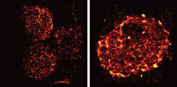 Image: Super-resolution imaging was used to capture the rearrangement of T-cell receptors from nanometer-scale protein islands (left) to micrometer-scale microclusters (right) after T-cell activation in mouse lymph nodes (Photo courtesy of the Salk Institute for Biological Studies).
