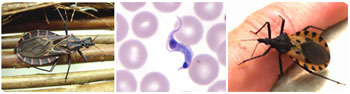 Image: Left and right: Various species of Triatomine bugs, which if infected can transmit T. cruzi. Center: T. cruzi trypomastigote in a thin blood smear stained with Giemsa (Photo courtesy of the CDC).