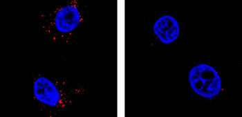 Image: The Zika virus infecting cells: Zika virus (red) infects cultured human cells (blue, left panel). Zika virus replication is inhibited (right panel) when endoplasmic reticulum membrane complex levels in the human cells are lowered (Photo courtesy of the University of Massachusetts Medical School).