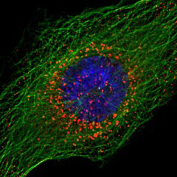 Image: HIV-1 viral cores (red) accumulate around the cell nucleus (blue) but remain unable to enter following depletion of the motor protein KIF5B (Photo courtesy of Loyola University Chicago).