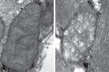 Image: Left: a normal mouse muscle mitochondrion. Right: a mitochondrion in mitofusin 2-deficient muscle (Photo courtesy of Dr. D. Sebastian, Institute for Research in Biomedicine, Barcelona).