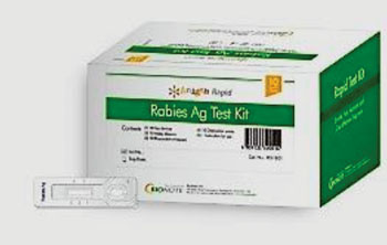 Image: The Rapid Rabies Ag Test Kit is a chromatographic immunoassay for the qualitative detection of Rabies virus antigen (Photo courtesy of Creative Diagnostics).