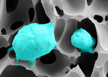 Image: A scanning electron microscope (SEM) micrograph of prostate cancer cells (green) growing in a superporous cryogel with tissue-like elasticity (Photo courtesy of Dr. Bettina Göppert, Karlsruhe Institute of Technology).