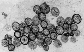 Image: A scanning electron micrograph (SEM) of Puumala virus, a species of hantavirus (Photo courtesy of Hans R. Gelderblom, Freya Kaulbars/RKI).