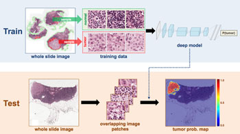 Image: The framework of cancer metastases detection (Photo courtesy of Andrew Beck / BIDMC).