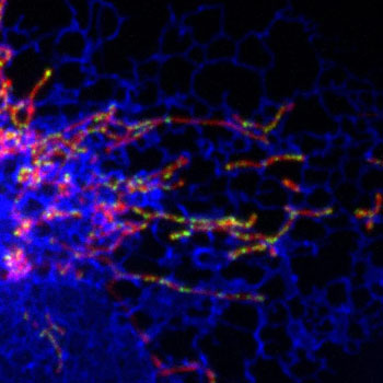 Image: Mitochondrial DNA (green spots) is found at points where mitochondria (blue) are in contact with the endoplasmic reticulum (red) (Photo courtesy of Dr. Samantha Lewis, University of California, Davis).
