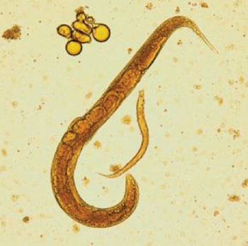 Image: A photomicrograph of an adult free-living female S. stercoralis alongside a smaller rhabditiform larva. Notice the developing eggs in the adult female (Photo courtesy of the CDC).