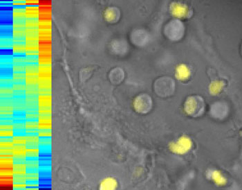 Image: Cells labeled to identify proteins that regulate the expression of a genetic switch for T-cells. On the right, T-cells where the switch is activated glow in yellow. On the left, the rainbow pattern, a hierarchical cluster analysis, tells investigators which genes are controlled by the switch. The horizontal stripes are the genes. If they stripes turn red going from left to right, it means they are turning on; if they turn blue, the genes are turning off (Photo courtesy of the California Institute of Technology).