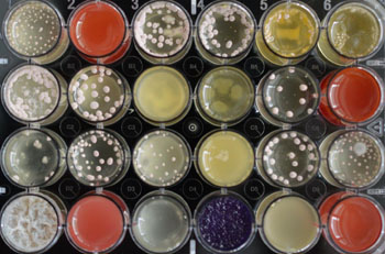 Image: Fungi can be stimulated with distinct substances for production of antibiotic metabolic products (Photo courtesy of BiMM Research).
