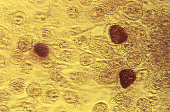 Image: A photomicrograph (200X) showing McCoy cell monolayers with Chlamydia trachomatis inclusion bodies (Photo courtesy of the CDC).