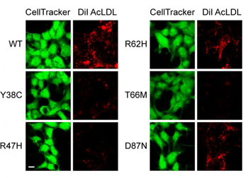 Image: This figure shows confocal images of cells, shown in green, and the corresponding uptake of lipoproteins in those cells, shown in red. Compared to cells with the wild type (WT) form of TREM2, cells with mutant forms of TREM2 (mutant forms Y38C, R47H, R62H, etc.) take up less lipoproteins (Photo courtesy of Dr. Felix Yeh, Genetech).