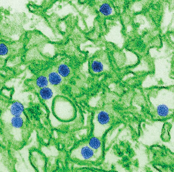 Image: A digitally colorized transmission electron micrograph (TEM) of Zika virus. Viral particles are 40 nm in diameter with an outer envelope and dense inner core (Photo courtesy of Cynthia Goldsmith / CDC).