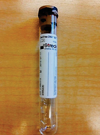 Image: A Cell-Free DNA BCT collection tube (Photo courtesy of Streck / Pathology Associates Medical Laboratory).