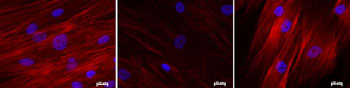 Image: From left to right, functioning stem cells, stem cells no longer functioning due to Hutchinson-Gilford Progeria syndrome (HGPS), and stem cells previously not functioning due to HGPS that were rebooted by the embryonic stem cell gene NANOG (Photo courtesy of Stelios Andreadis, University at Buffalo).